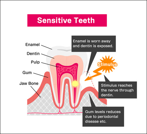 Sensitive Teeth